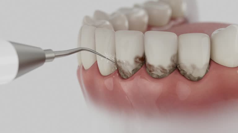 Reliable Tooth Extraction contractor in Barton County County, MO by Dentist Open Now